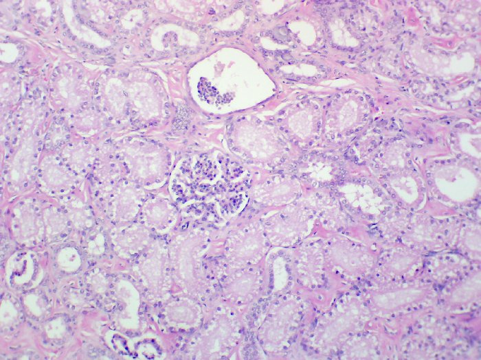 Human kidney stained progressively with hemalum and eosin Y at 100x magnification