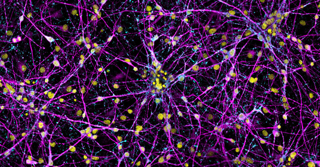 Immunofluorescence for MAP2 (magenta), synapsin 1 (yellow), and DAPI (cyan) in day 35 hiPSC-derived forebrain neurons