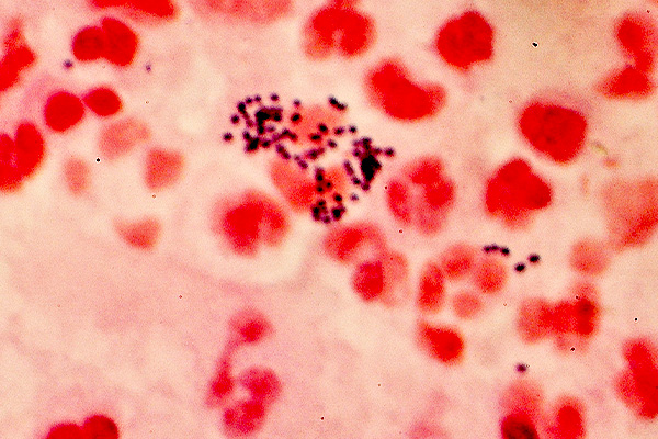 Gram-positive staining of streptococci
