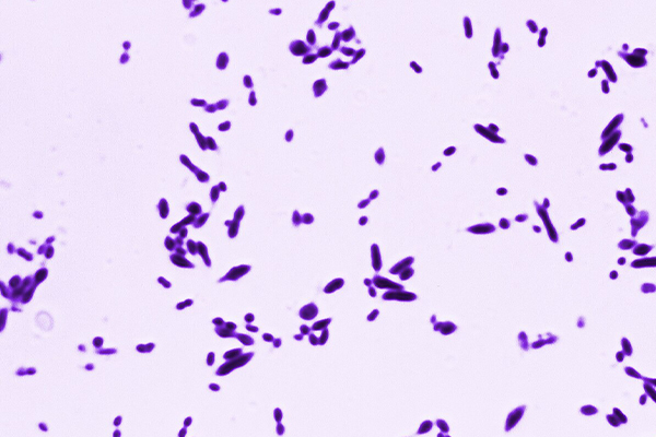 Gram-positive staining of Streptococcus pneumoniae diplococcal bacteria, 1700X magnification