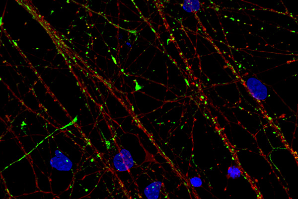 Immunofluorescence for beta-tubulin (red), synaptophysin (green), and DAPI (blue) in day 35 hiPSC-derived forebrain neurons