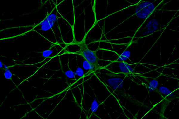 Immunofluorescence for MAP2, synapsin 1, and DAPI in day 35 hiPSC-derived forebrain neurons