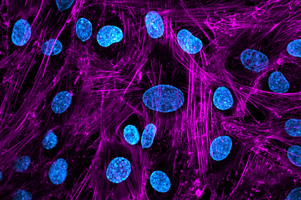 Immunofluorescence for phalloidin and DAPI of human bone marrow-derived mesenchymal stem cells