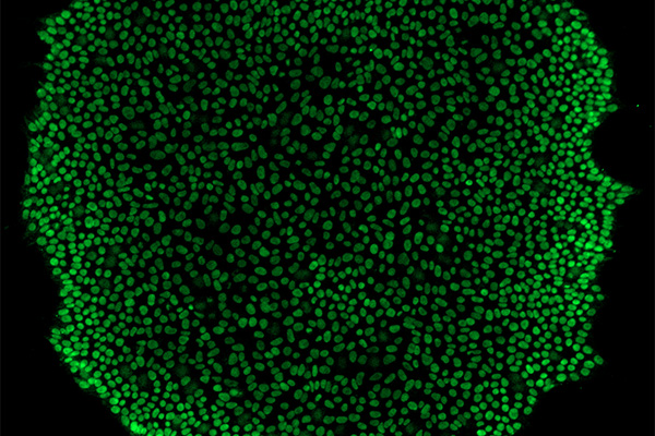Immunofluorescence for the stem cell marker, Sox2, in 3A hiPSC colony