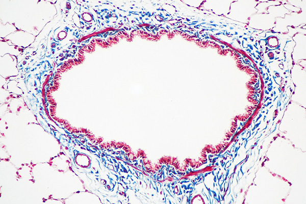 Masson's trichrome staining of rat airway tissue