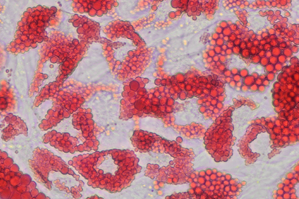 Oil red O staining of day 11 differentiated adipocytes, 40x magnification