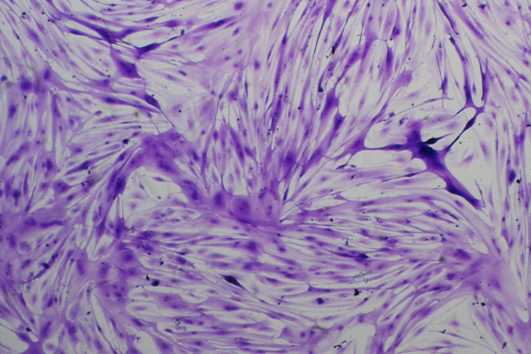 Toluidine blue staining of day 11 diffferentiated myoblasts, 4X magnification