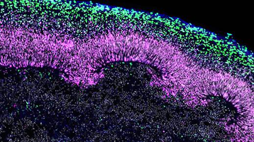 Immunofluorescence for CTIP2 (green), PAX6 (magenta), βIII-tubulin/TUJ1 (blue), and DAPI (gray) in day 40 cryosectioned cerebral organoids