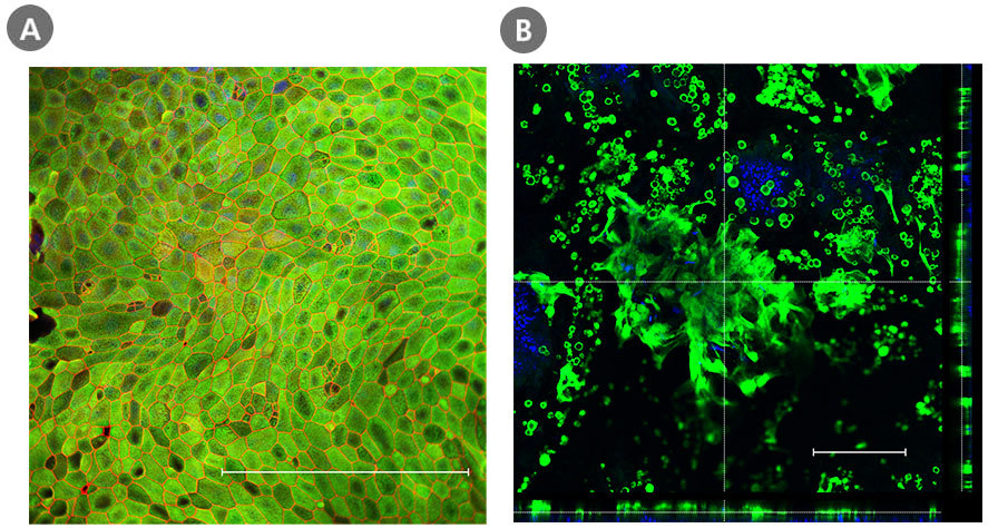 Immunofluorescence for KRT20 (green) and ZO-1 (red) in day 7 monolayers or MUC2 (green) in day 14 air-liquid interface (ALI) cultures of intestinal cells